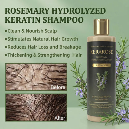 Kerarose Rosemary Shampoo For Hair Growth (Buy 1 Get 1 Free 🔥🔥)