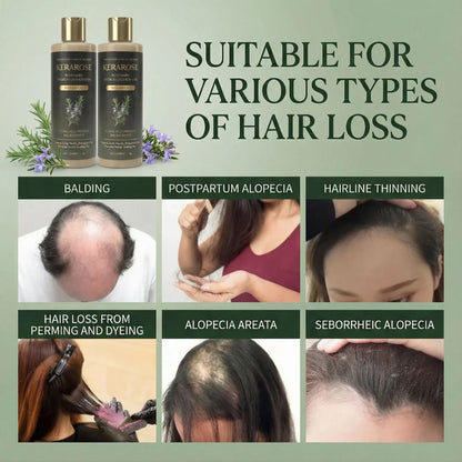 Kerarose Rosemary Shampoo For Hair Growth (Buy 1 Get 1 Free 🔥🔥)
